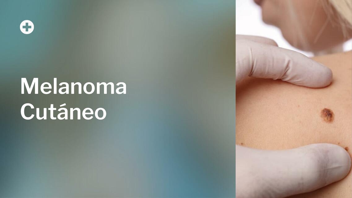 Melanoma Cutáneo 