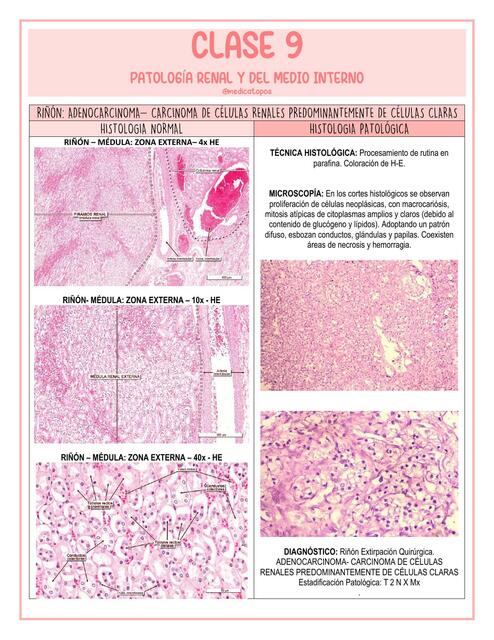 Clase 9 Patología Renal y del Medio Interno 