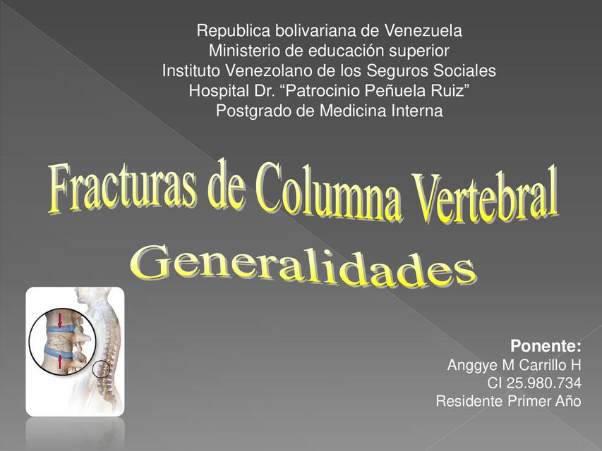 Fractura de columna vertebral