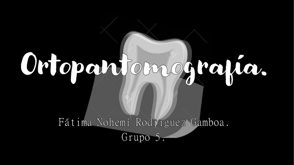 Estructuras anatómicas en ortopantomografía