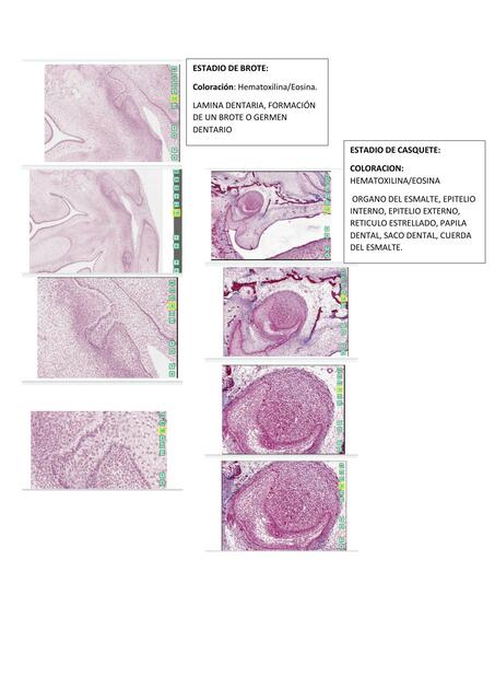 Práctica Odontogénesis