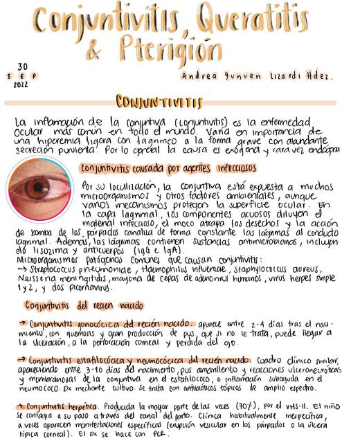 Conjuntivitis queratitis y pterigión