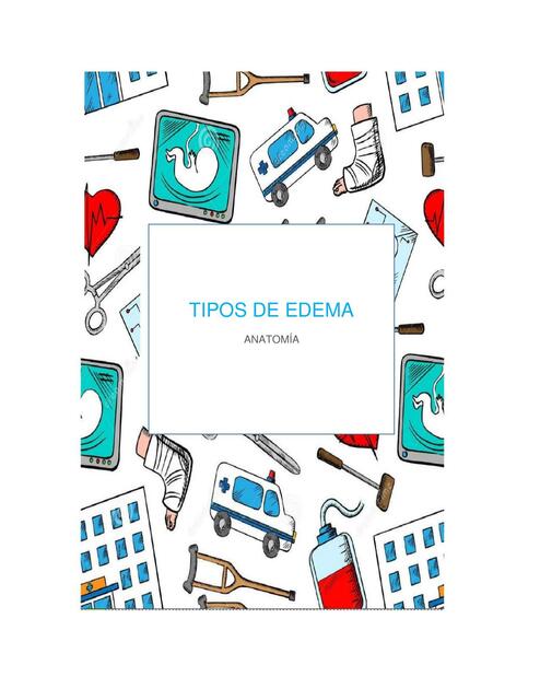 Tipos de Edema 