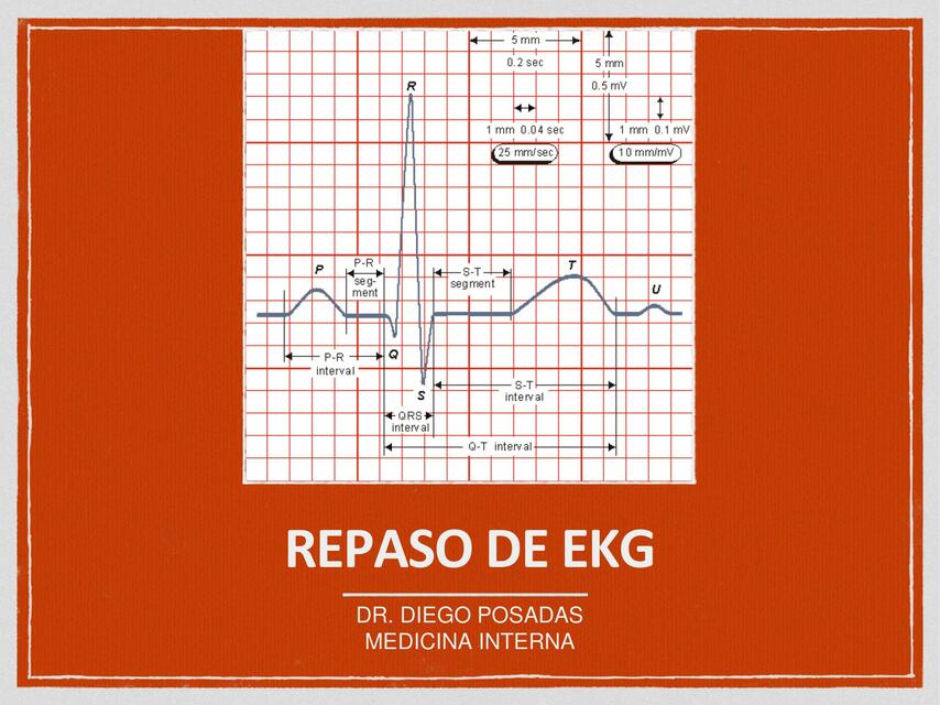 Electrocardiograma