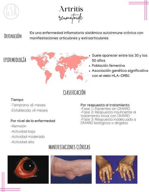 Artritis Reumatoide