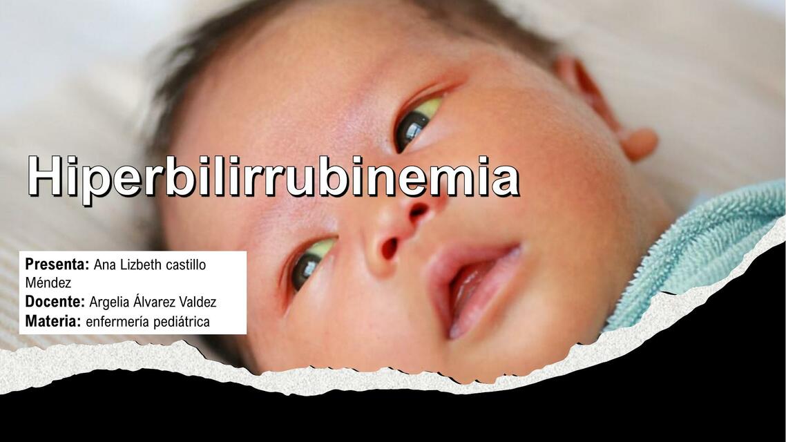 Hiperbilirrubinemia