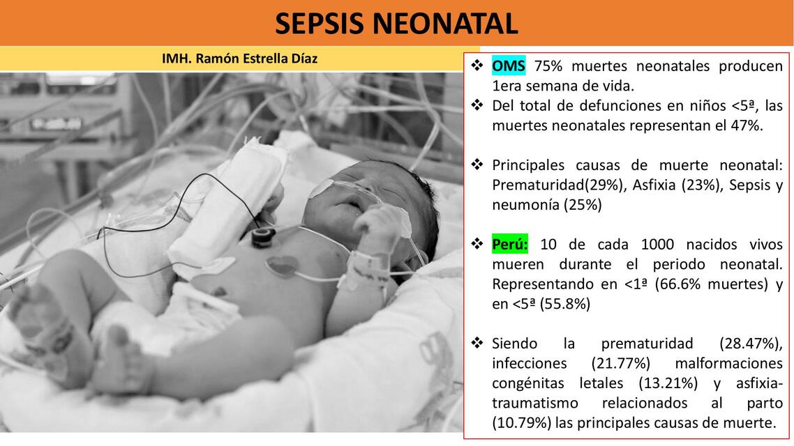 Sepsis Neonatal