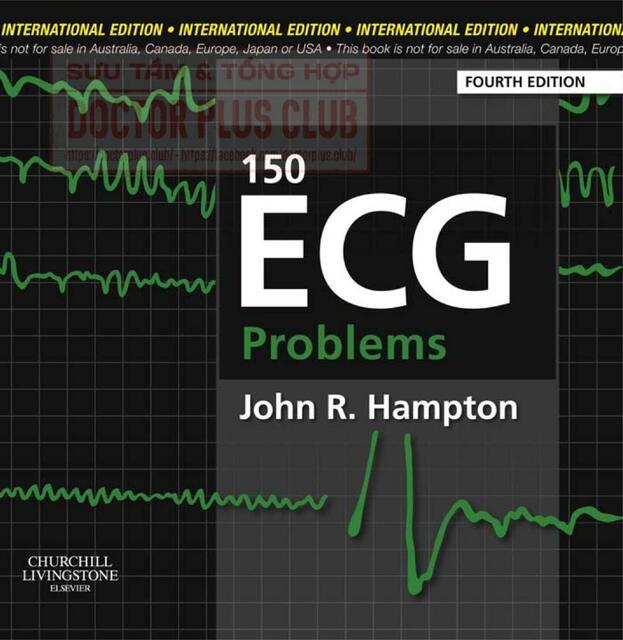 150 ECG Problems 