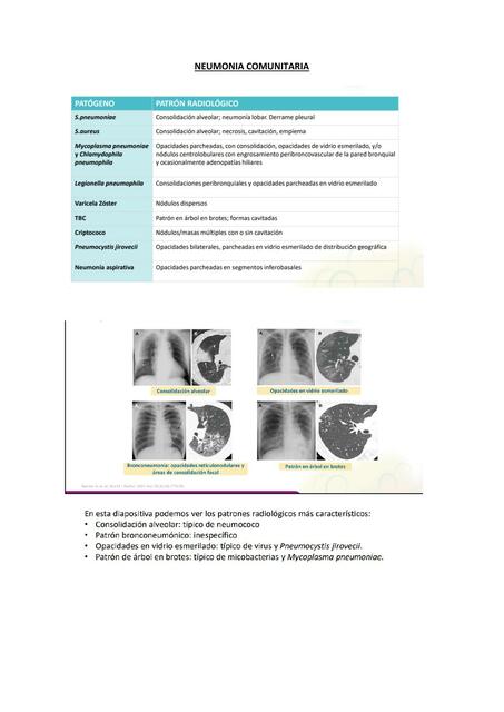 Neumonía  Comunitaria  Formato  PDF