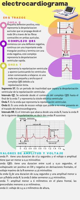 Electrocardiograma 