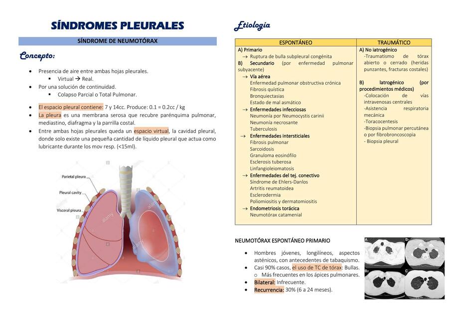  Síndromes Pleurales