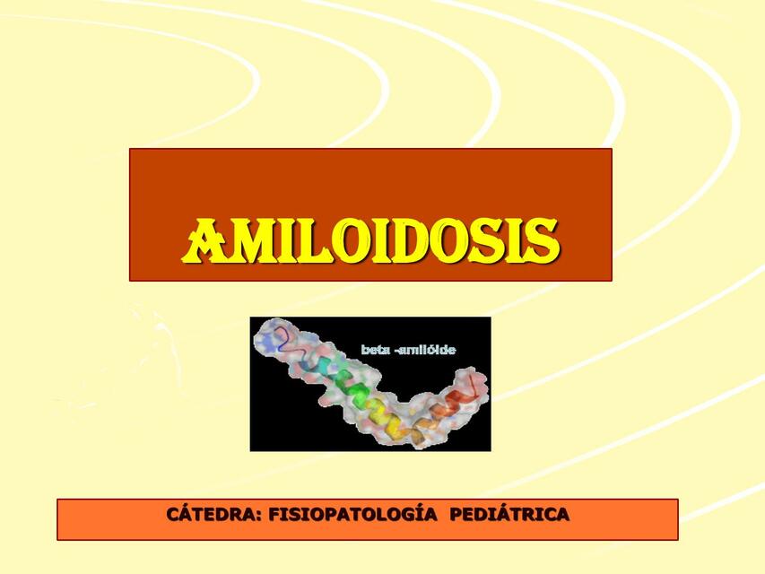 Amiloidosis  PPT