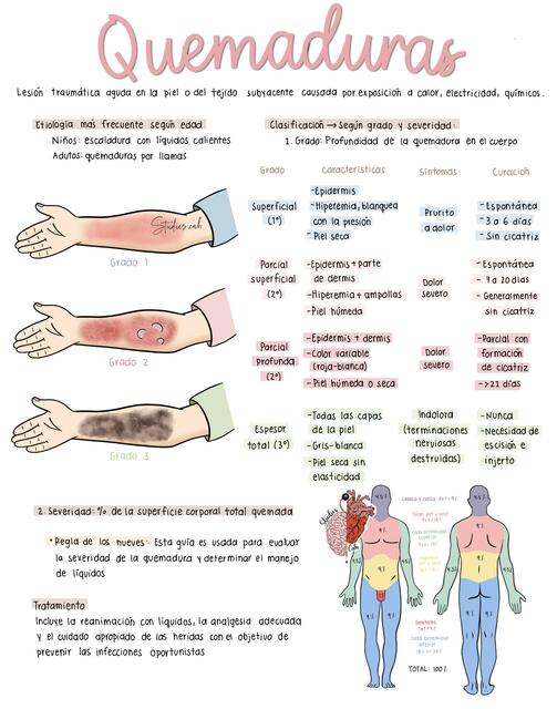 Quemaduras
