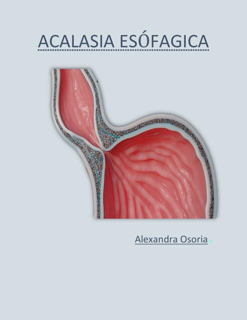 Acalasia esófagica