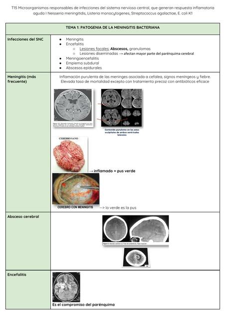 Patogenia de la Meningitis Bacteriana 