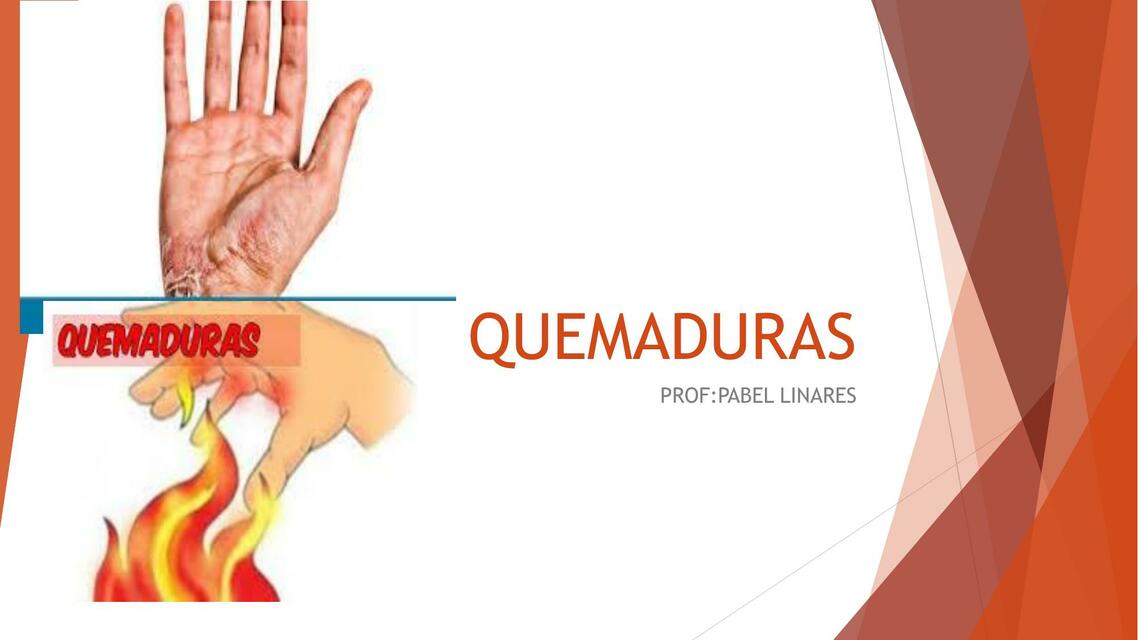 Quemaduras 