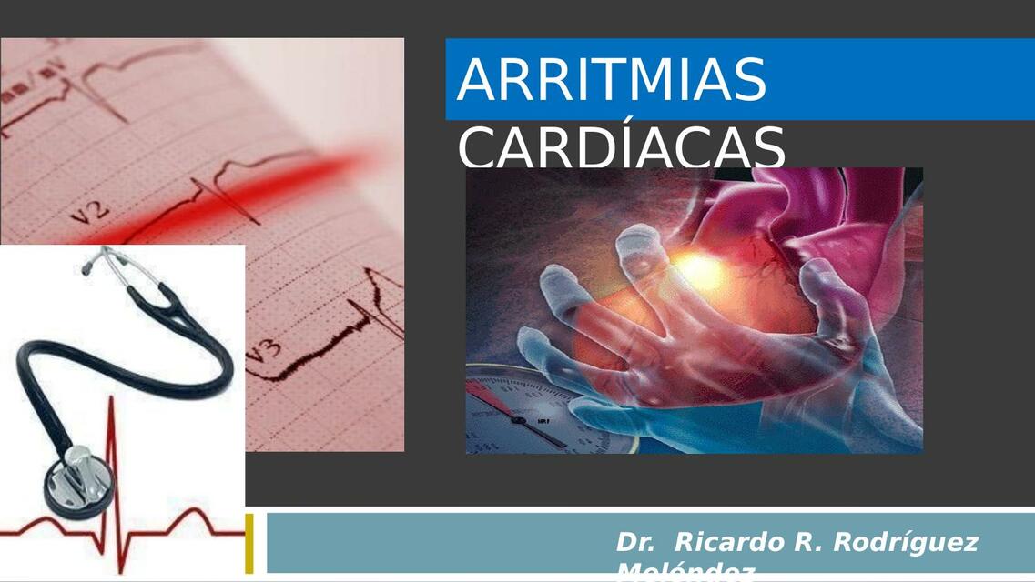 Arritmias cardíacas