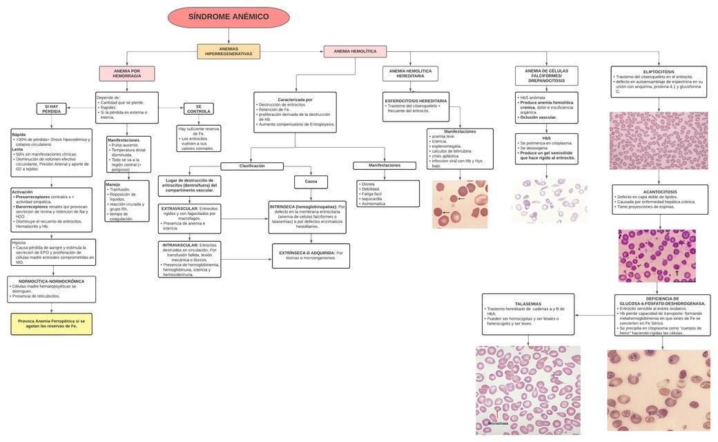 Anemias  Hiperregenerativas  (Síndrome  Anémico )