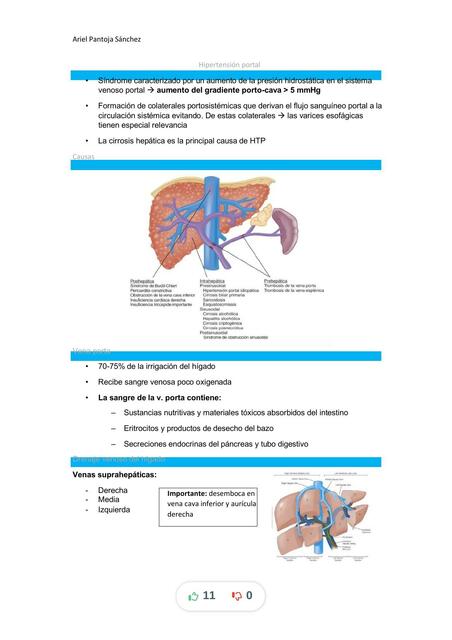 Hipertensión portal resumen principios de medicina