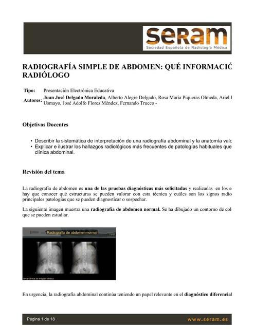 Radiografía Simple de Abdomen 