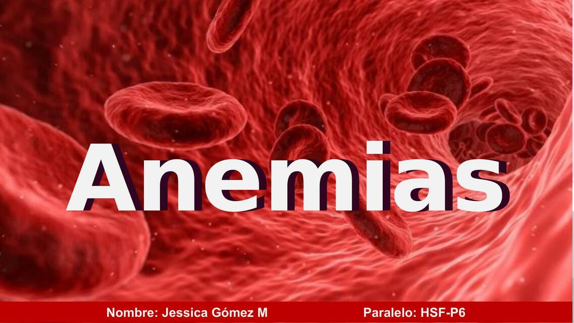 Anemias 