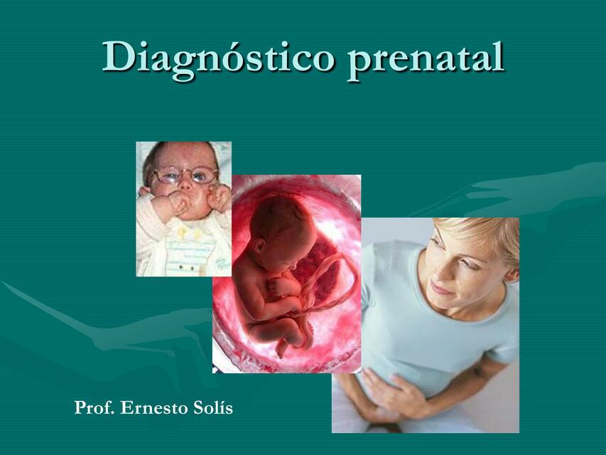 Diagnóstico Prenatal