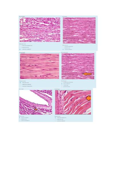 Cuestionario de Tejido Muscular histología 