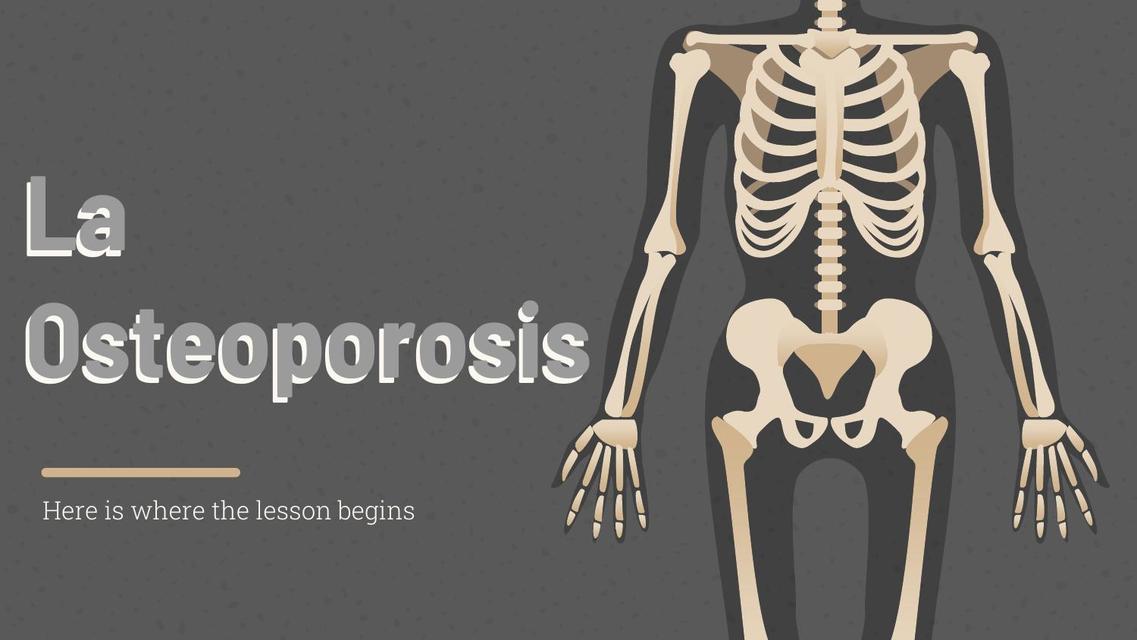 La Osteoporosis       