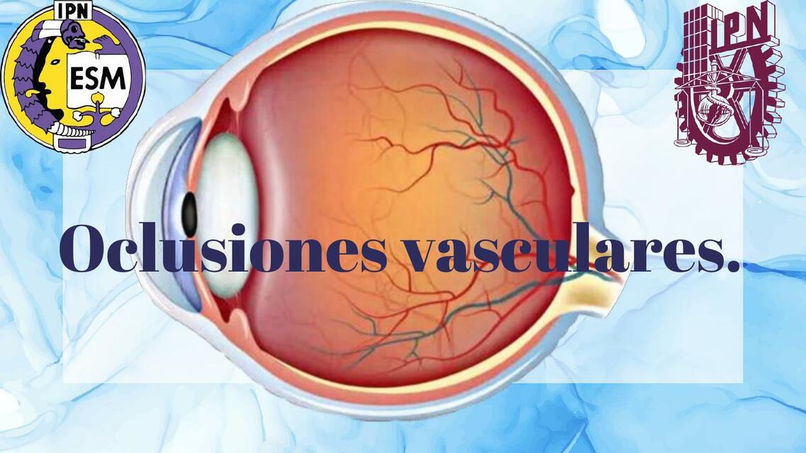 Oclusiones Vasculares