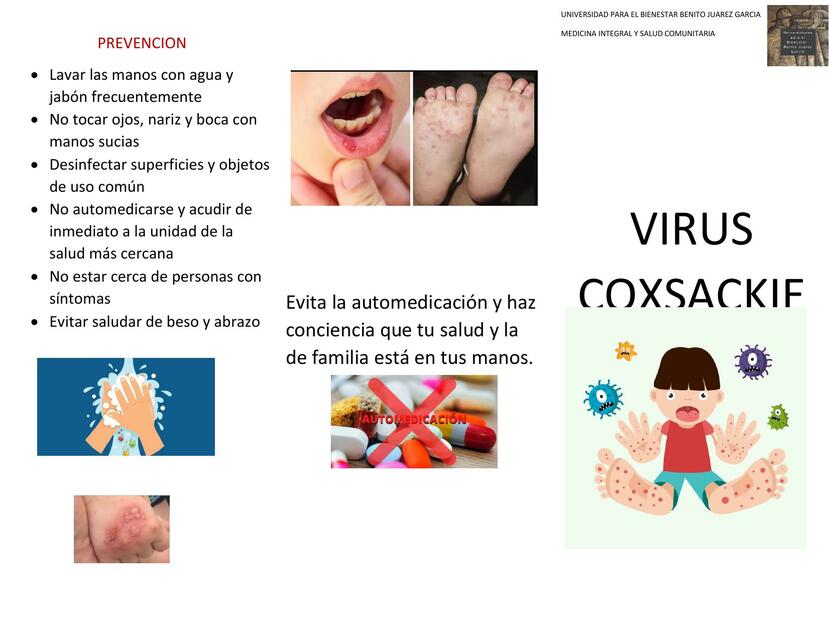 Virus Coxsackie