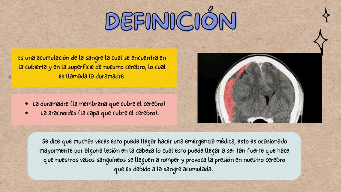 Hematoma Subdural 