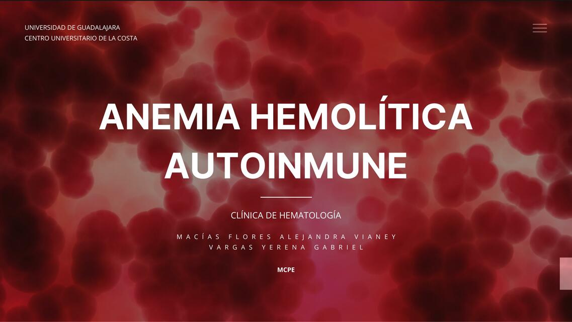 Anemia Hemolítica Autoinmune 