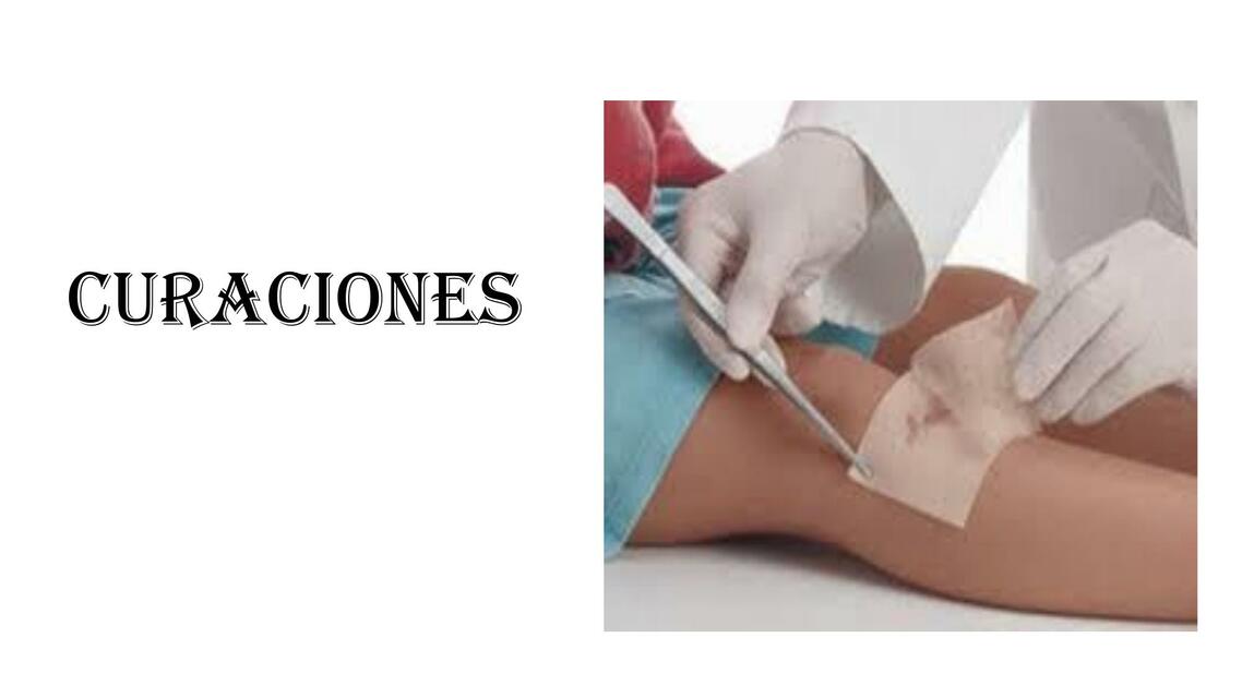 Curaciones 