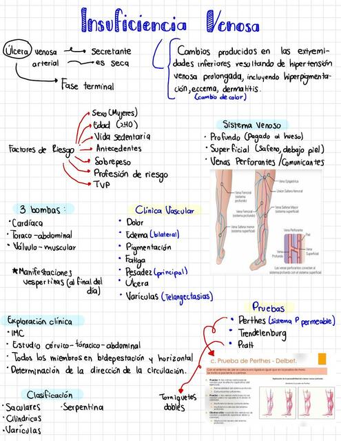 Insuficiencia Venosa