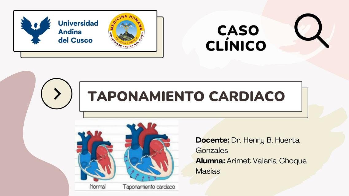 Taponamiento Cardíaco | UDocz