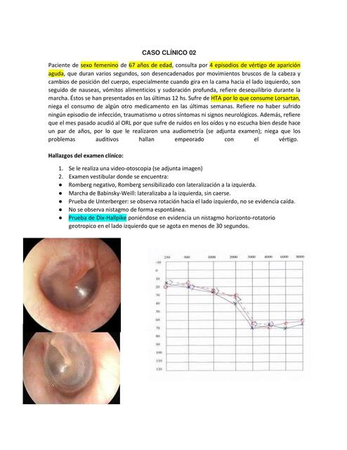 Vértigo Posicional Paroxístico Benigno Presbiacusia 