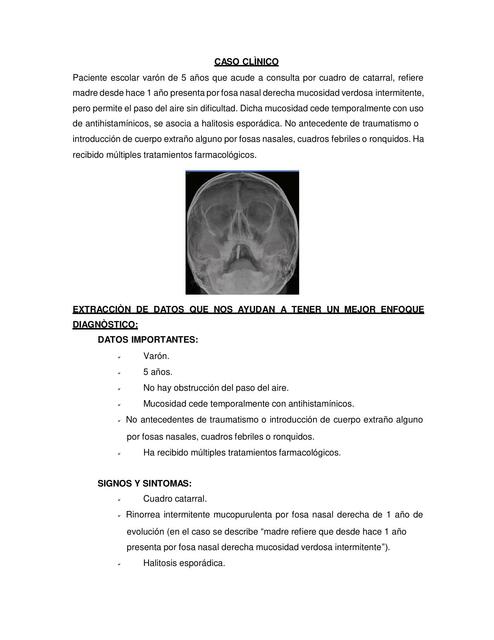 Rinosinusitis Aguda 