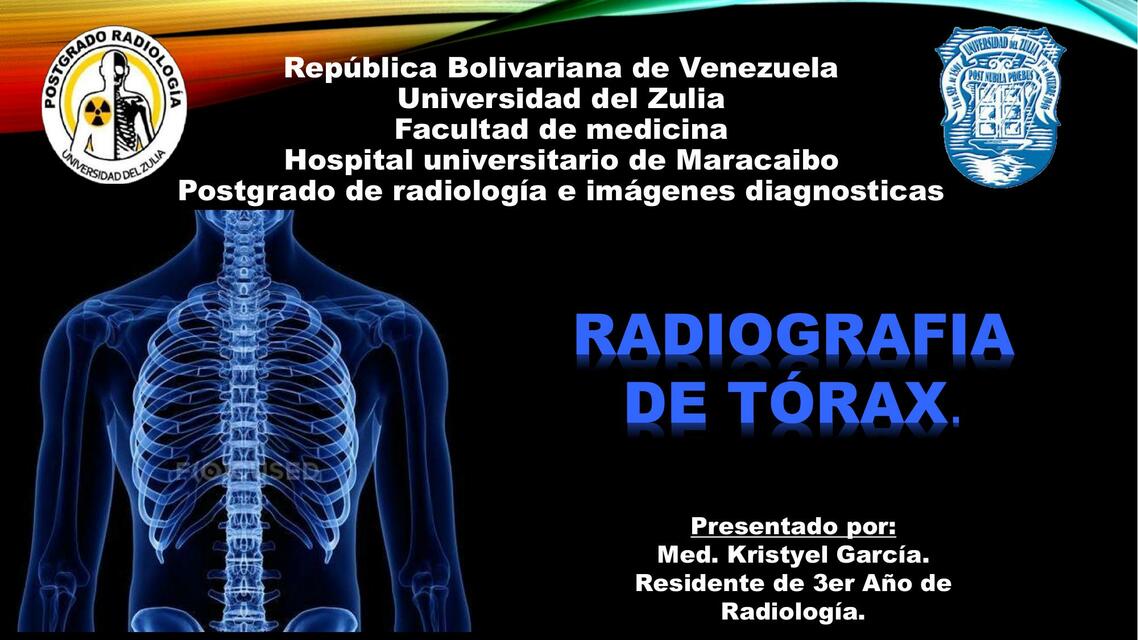 Radiografía de Tórax 