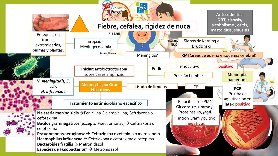 Fiebre, Cefalea, Rigidez de Nuca 