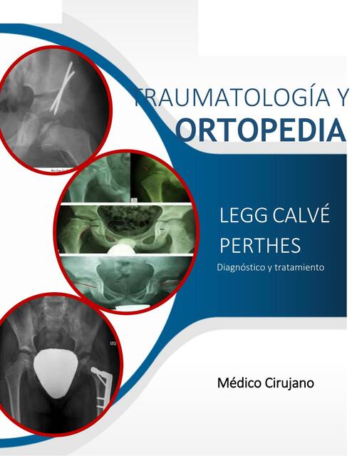 Traumatología y Ortopedia 