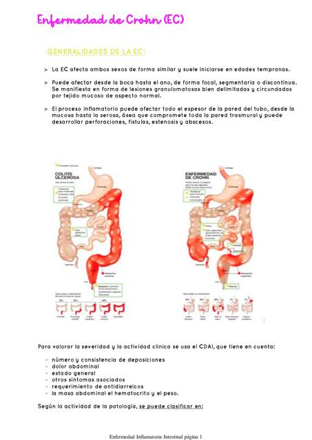 Enfermedad de Crohn (EC)