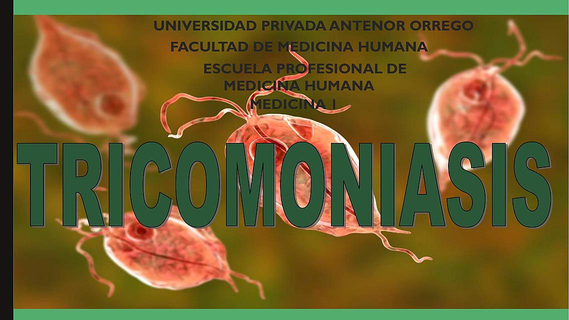 resumen trichomoniasis