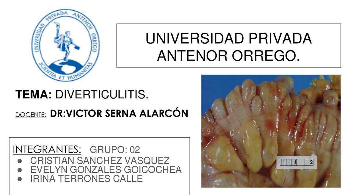 Diverticulitis 