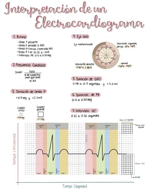 Interpretación de un Electrocardiograma 