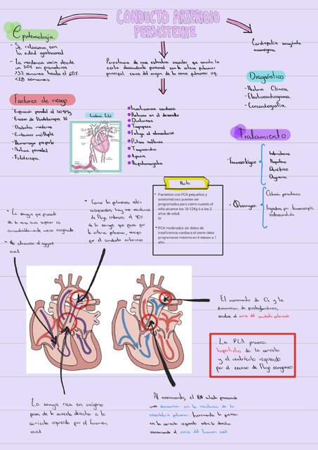 Conducto Arterioso Persistente