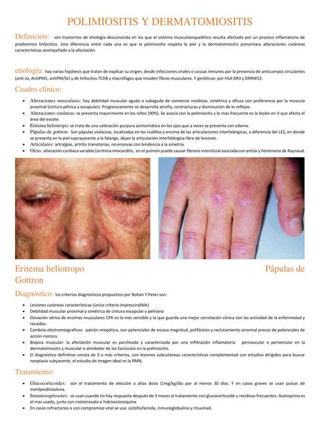 Polimiositis y Dermatomiositis REUMATOLOGIA UDOCZ