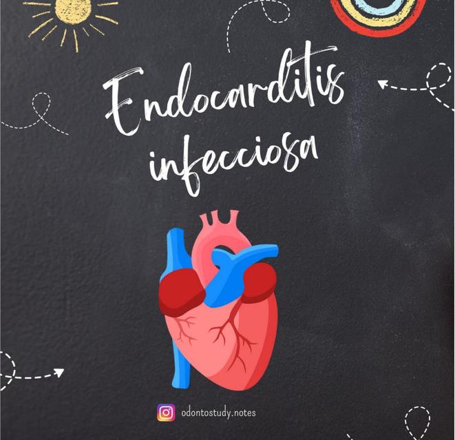 Endocarditis infecciosa   