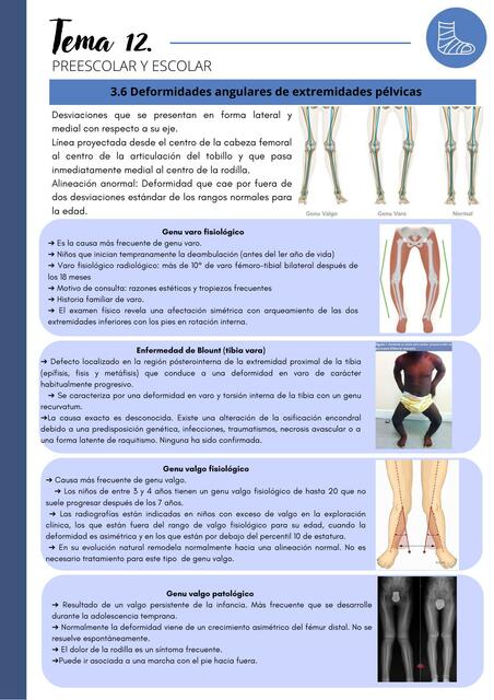 Ortopedia y trauma: Preescolar y escolar, deformidades angulares de extremidades pélvicas