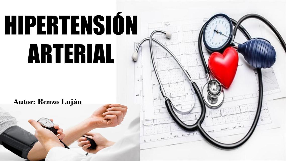 HIPERTENSIÓN ARTERIAL FISIOPATOLOGIA Y CLINICA