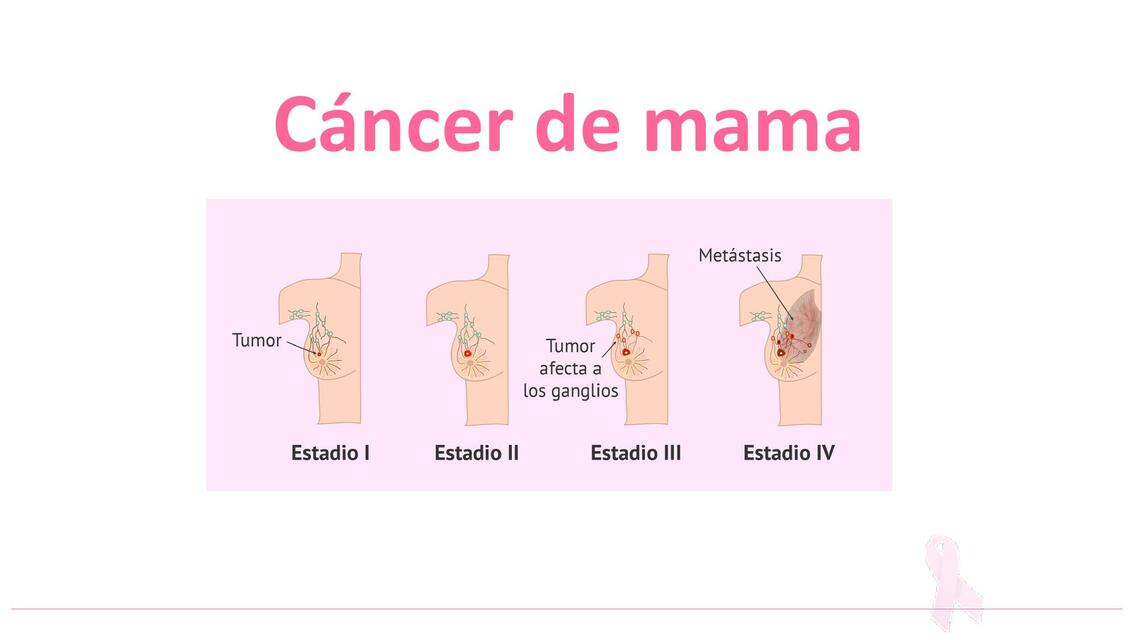 Cáncer de Mama